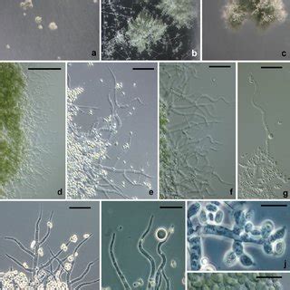 Trichoderma Barbatum A C Pustules On Cmd D F Hairs On Conidial