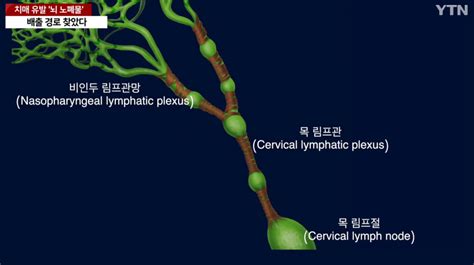 국내에서 세계최초로 치매 유발 뇌 노폐물 배출 경로 찾았다 미스터리공포 에펨코리아