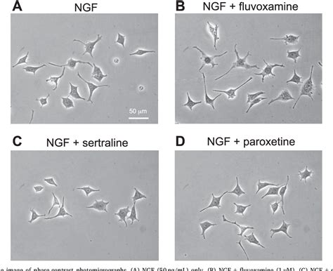 Figure 2 From Sertraline Inhibits Nerve Growth Factor‐induced Neurite