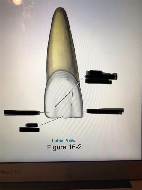 Anterior Teeth Part 1 Diagram Quizlet