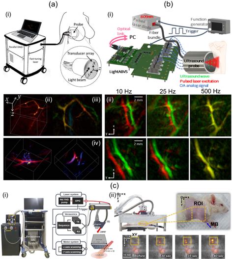 Figure From Review Of Three Dimensional Handheld Photoacoustic And