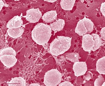 Archaebacteria - 6 Kingdoms of Life