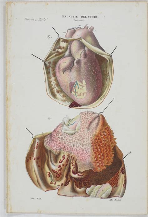 Malattie Del Cuore Tafeln Aus Atlante Generale Della Anatomia