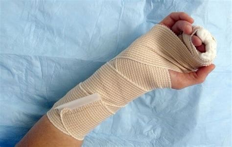 Radial Gutter Splint Wikism Sports Medicine Wiki