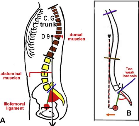 A Economic Sagittal Balance Of The Trunk On The Lower Limbs Based On