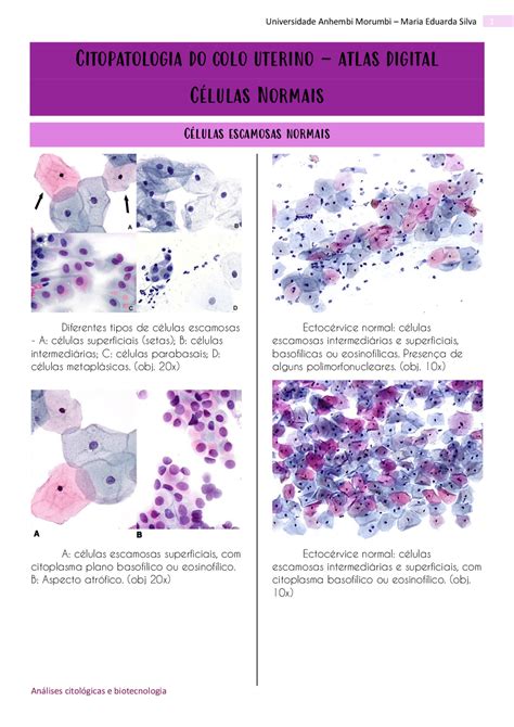 Atlas De Citopatologia Do Colo Uterino C Lulas Normais Manuais