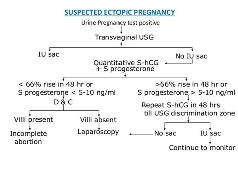 Ectopic Pregnancy