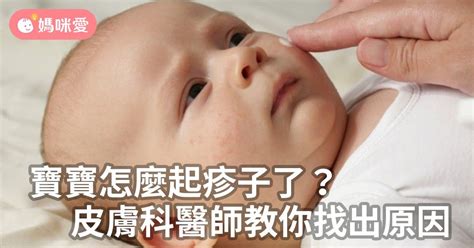 寶寶怎麼起疹子了皮膚科醫師教你找出原因 育兒文章媽咪愛