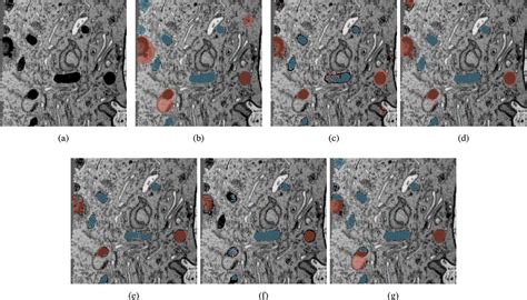 Figure From Automatic Segmentation Of Mitochondria And Endolysosomes