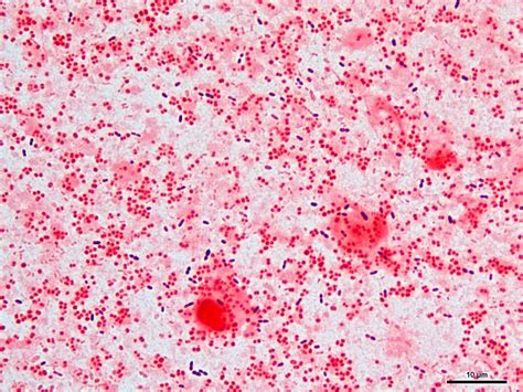 Moraxella Catarrhalis Gram Stain