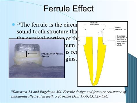 6restoration Of The Endodontically Treated Tooth