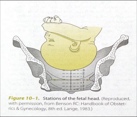 Obstetrics Flashcards Quizlet