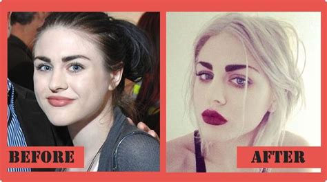 Frances Bean Cobain Plastic Surgery Is A Hot Celebrity Rumor Plastic Surgery Frances Bean