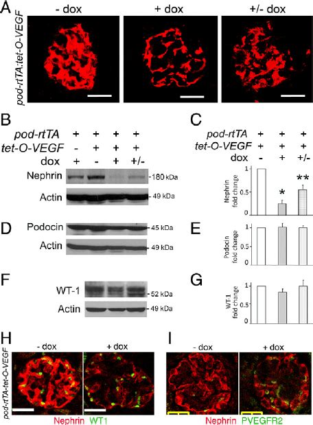 Podocyte Vegf 164 Overexpression Induces Nephrin Down Regu Download