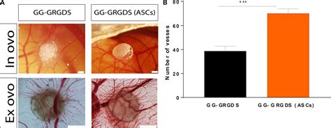 Frontiers In Vitro Evaluation Of ASCs And HUVECs Co Cultures In 3D