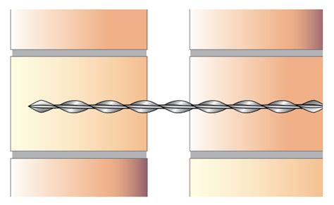 Heli Helical Ties Vista Engineering