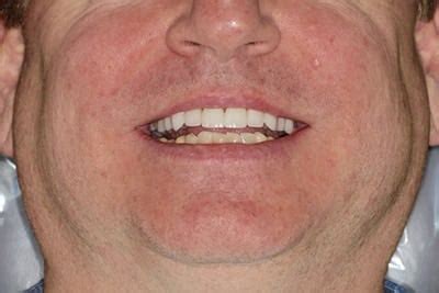 Smile Gallery Marcus Black Dds Best Dentist In Rogers Ar