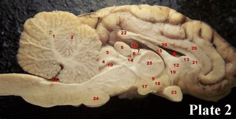 9 Nervous Tissue And Brain Anatomy Sheep Brain Dissection Diagram