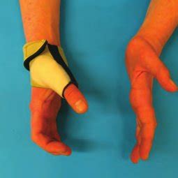 Neoprene short thumb opponens splint | Download Scientific Diagram