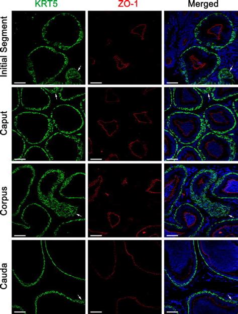 Double Immunolabeling Of KRT5 Green A Basal Cell Marker And ZO 1