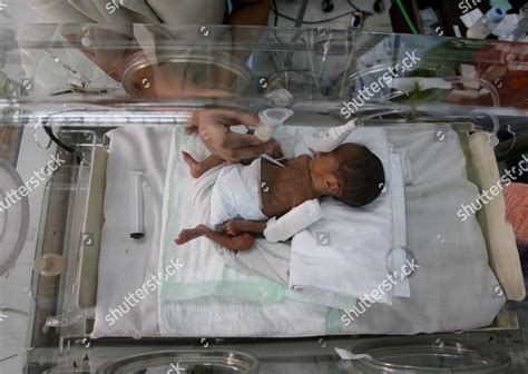 Filipino Infant Born 28 Weeks Premature Editorial Stock Photo - Stock Image | Shutterstock