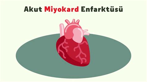 Myokard Enfarktüsü Örnek Video 3 Youtube