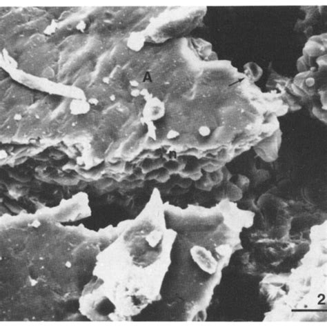 RBC with the aspects of knizocyte (k), discocyte (d), spherostomatocyte ...