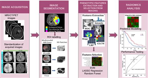 Pipeline Showing Radiomics Workflow Acquired Clinical Images Are