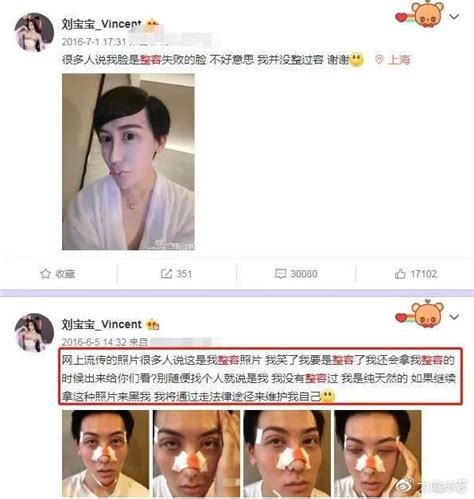 「蛇精男」劉梓晨毀容了？坦言受打擊太大，臉已經無法拍照了！ 每日頭條