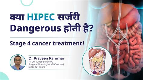 क्या Hipec सर्जरी Dangerous है Advances In Stage 4 Cancer Treatment Dr Praveen Kammar