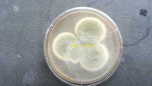 Sabouraud Dextrose Agar Sda Introduction Principle Composit