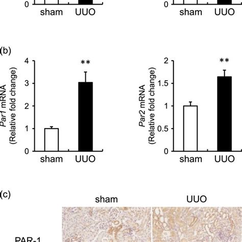 Expression Of Coagulation Factors And Protease Activated Receptors