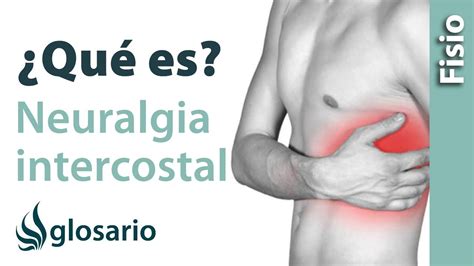 Neuralgia Intercostal Qu Es Youtube