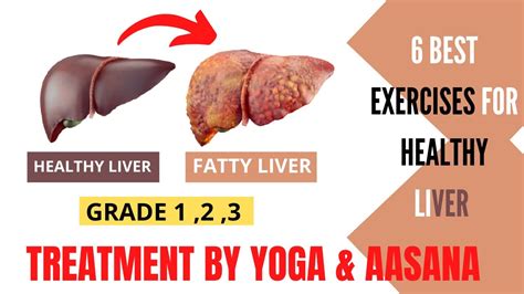 Fatty Liver Grade 1 2 3 complications treatment by Yoga ६ आसन जस