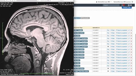 Training Drchrono Charts And Clinical Notes Patient Documents Youtube