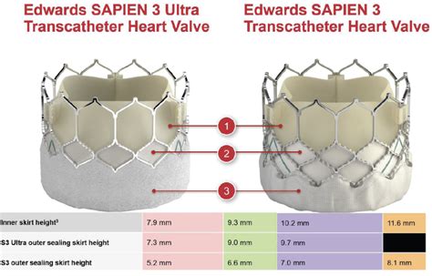 Edwards Lifesciences Solutions For Cardiac Care