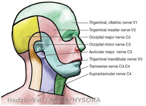 Ultrasound Guided Cervical Plexus Block Nysora The New York School Of Regional Anesthesia