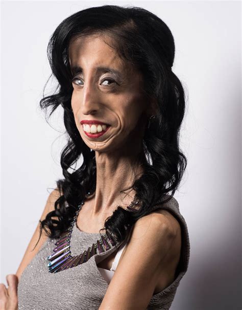 Online Bullies Called Me The World S Ugliest Woman Lizzie Velasquez Takes A Stand Nz Herald