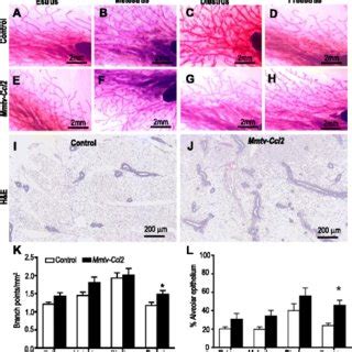 The Effect Of CCL2 Overexpression On Mammary Epithelial Cell