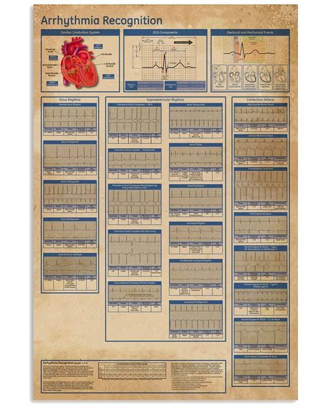 Cardiologist Arrhythmia Recognition