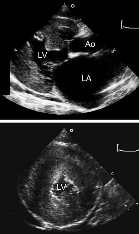 Heart Hypertrophic Cardiomyopathy Echocardiogram In Cats Felis