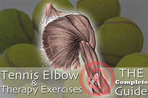 Tennis Elbow & Exercises for Therapy: The Complete Overview & PDF Handout