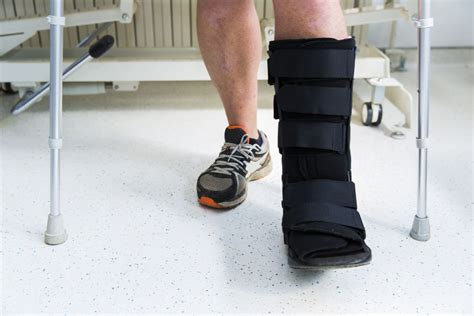 What To Expect If You Have A Broken Foot