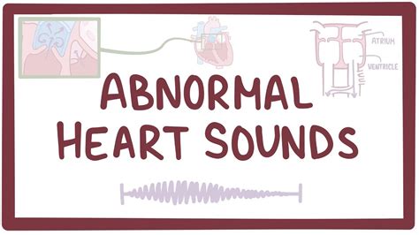 Normal Heart Sounds: Video, Anatomy Definition Osmosis, 52% OFF