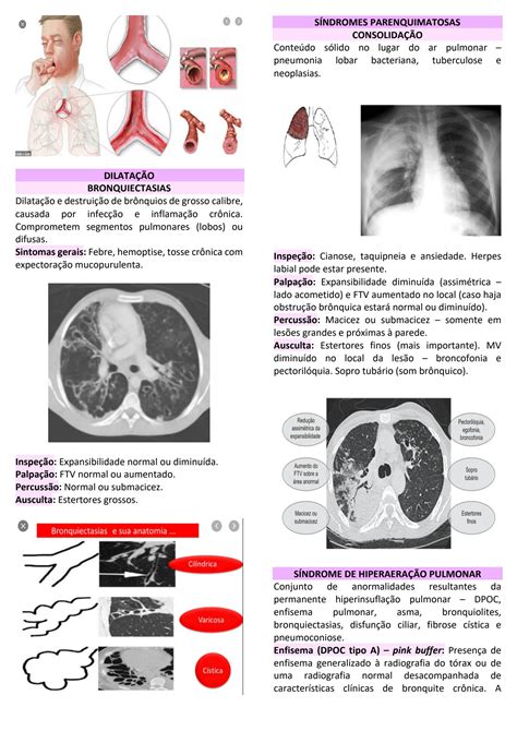 SOLUTION Síndromes pleuropulmonares resumo Studypool