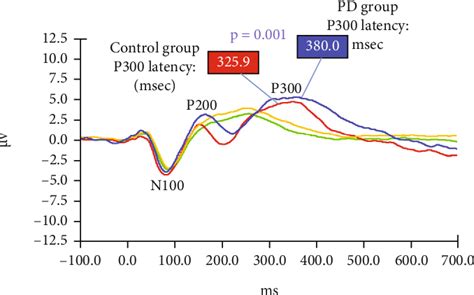 Pdf Electrophysiological Evidence Of Auditory And Cognitive