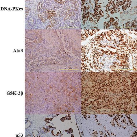 Shows Mrna Expression Of Dna Pkcs Akt3 Gsk 3β And P53 In The Ovarian Download Scientific