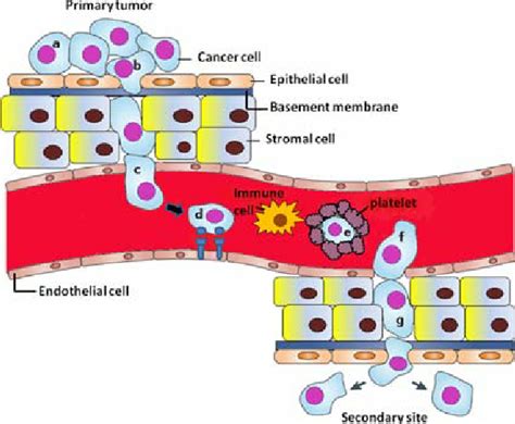 Steps Of Metastasis The Metastatic Cells A Reduce Adhesion To