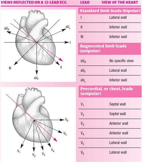 Basic 12 Lead Electrocardiography Anesthesia Key