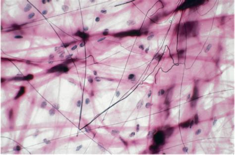 Histology Connective Tissue Identification Flashcards Quizlet